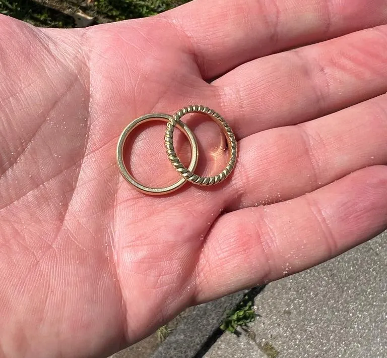 Ringe beim Volleyball zu tragen, ist nie eine gute Idee
